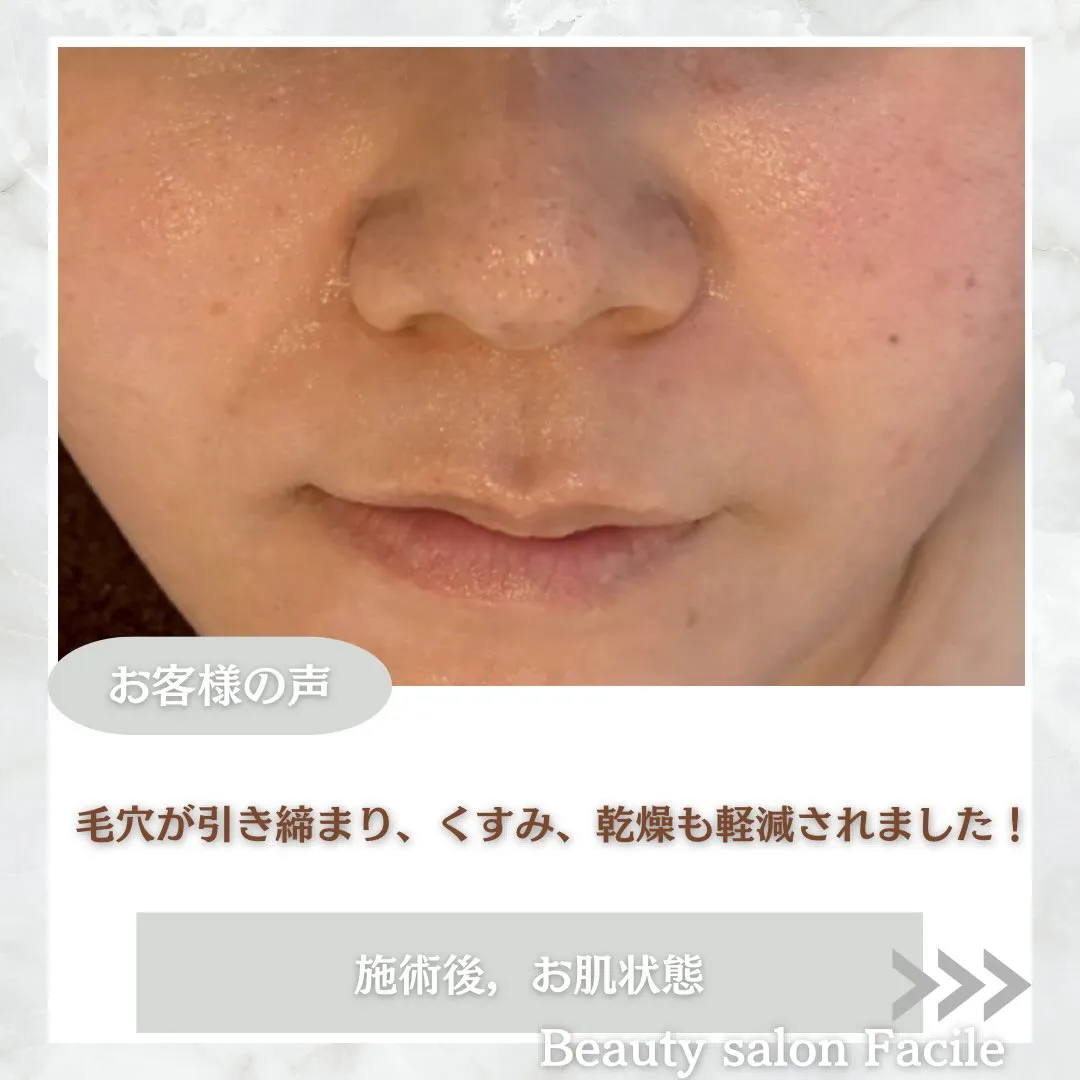 @beautysalonfacile 👈🏻他投稿もチェック