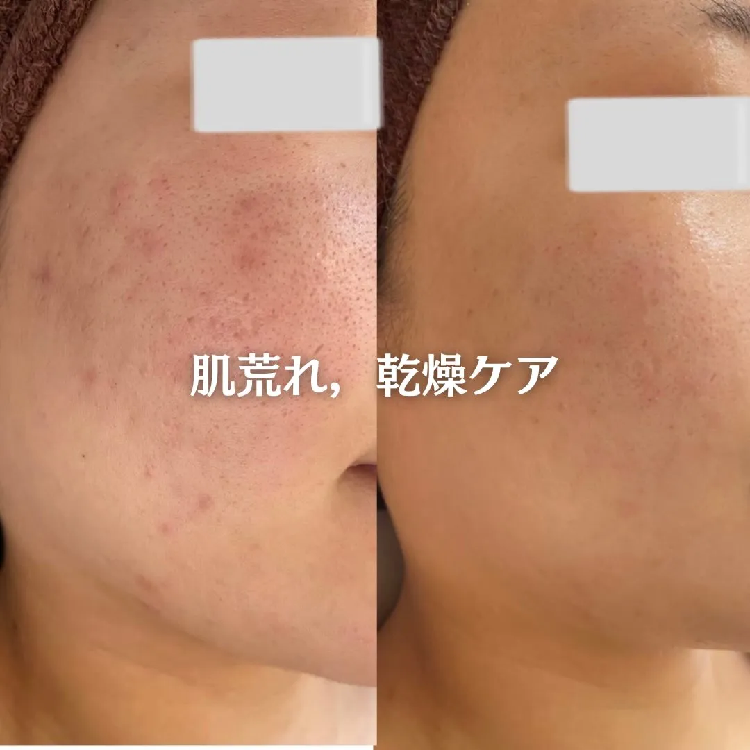 @beautysalonfacile 👈🏻他投稿もチェック