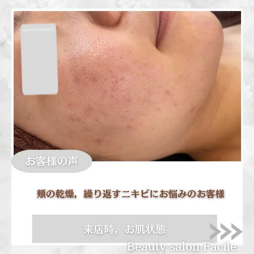 @beautysalonfacile 👈🏻他投稿もチェック