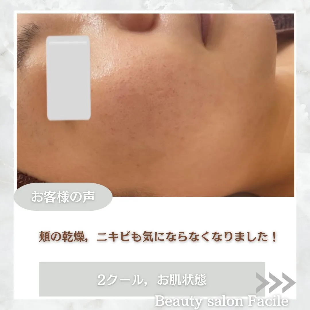 @beautysalonfacile 👈🏻他投稿もチェック