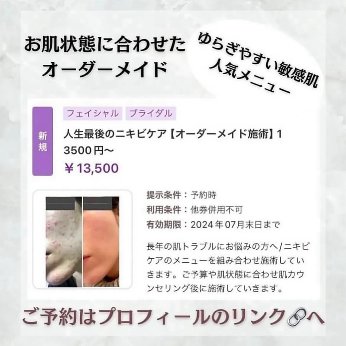 @beautysalonfacile 👈🏻他投稿もチェック