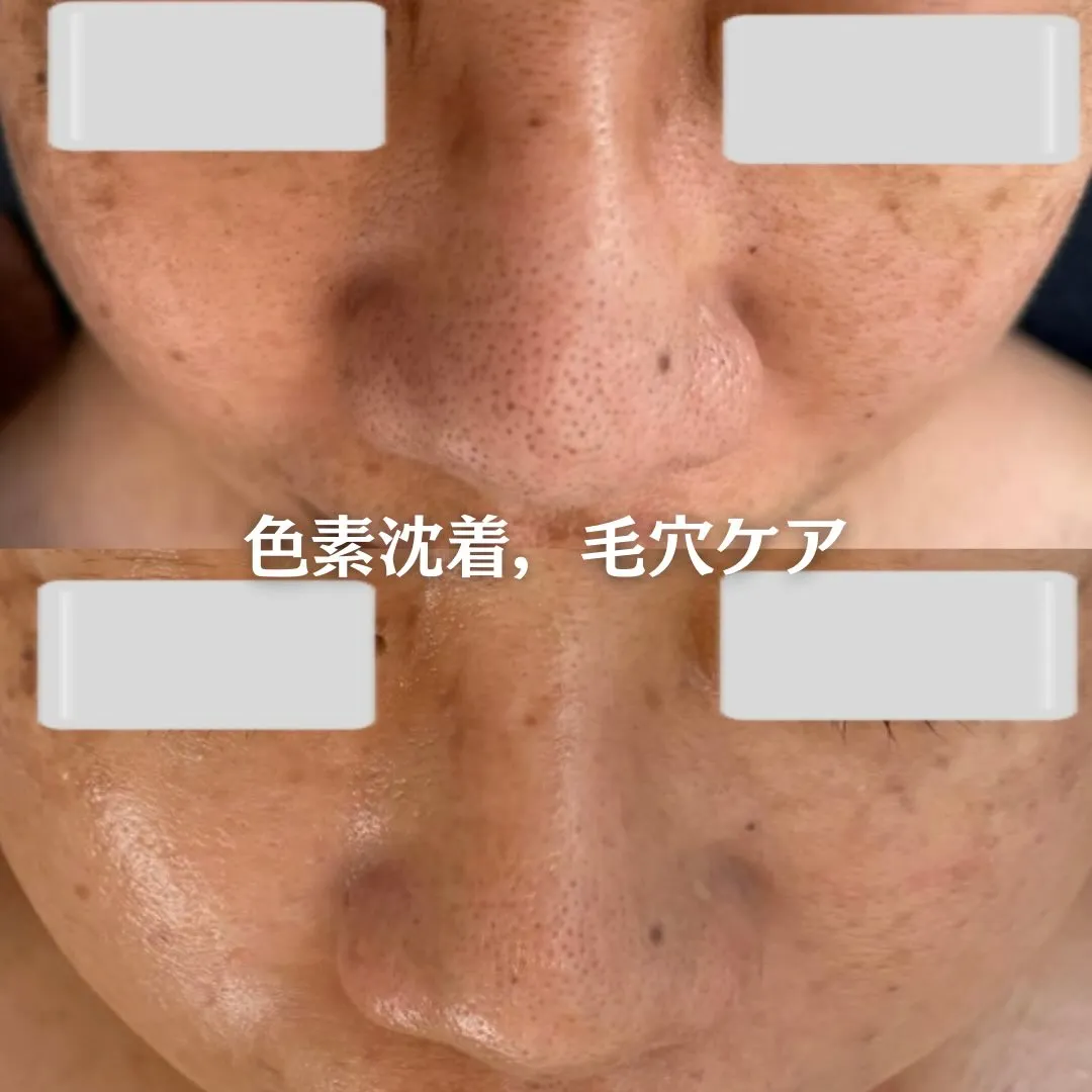 @beautysalonfacile 👈🏻他投稿もチェック