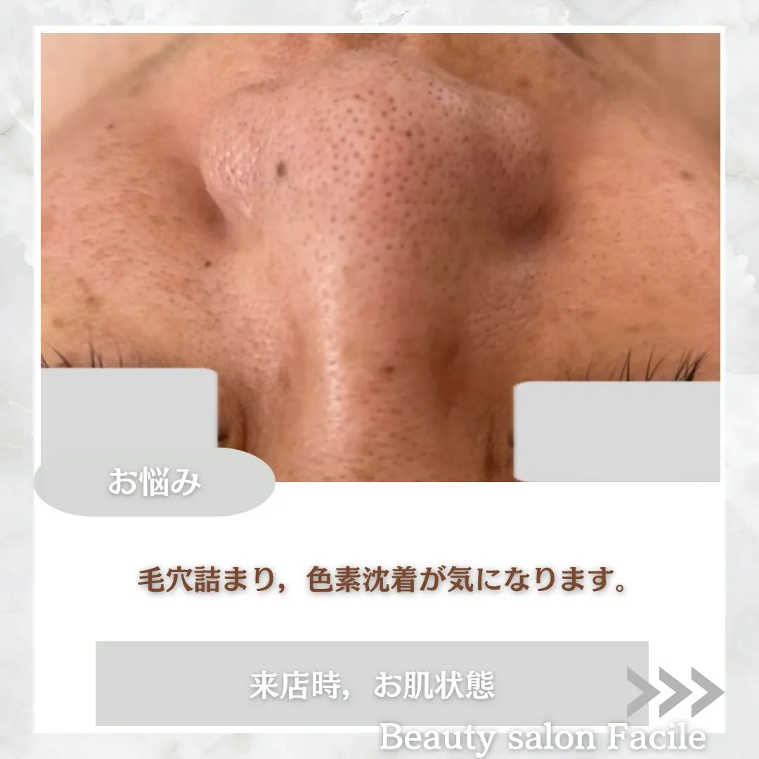 @beautysalonfacile 👈🏻他投稿もチェック