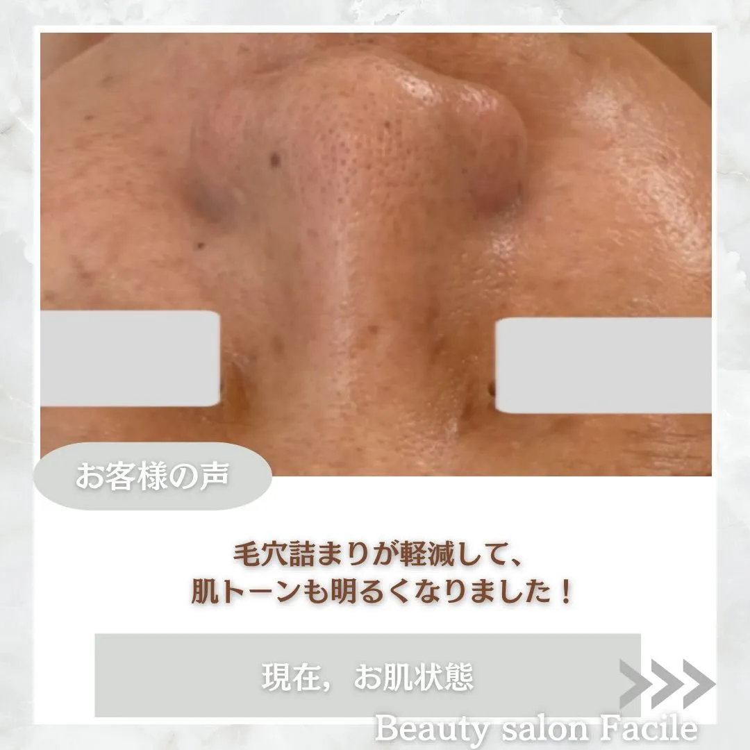 @beautysalonfacile 👈🏻他投稿もチェック