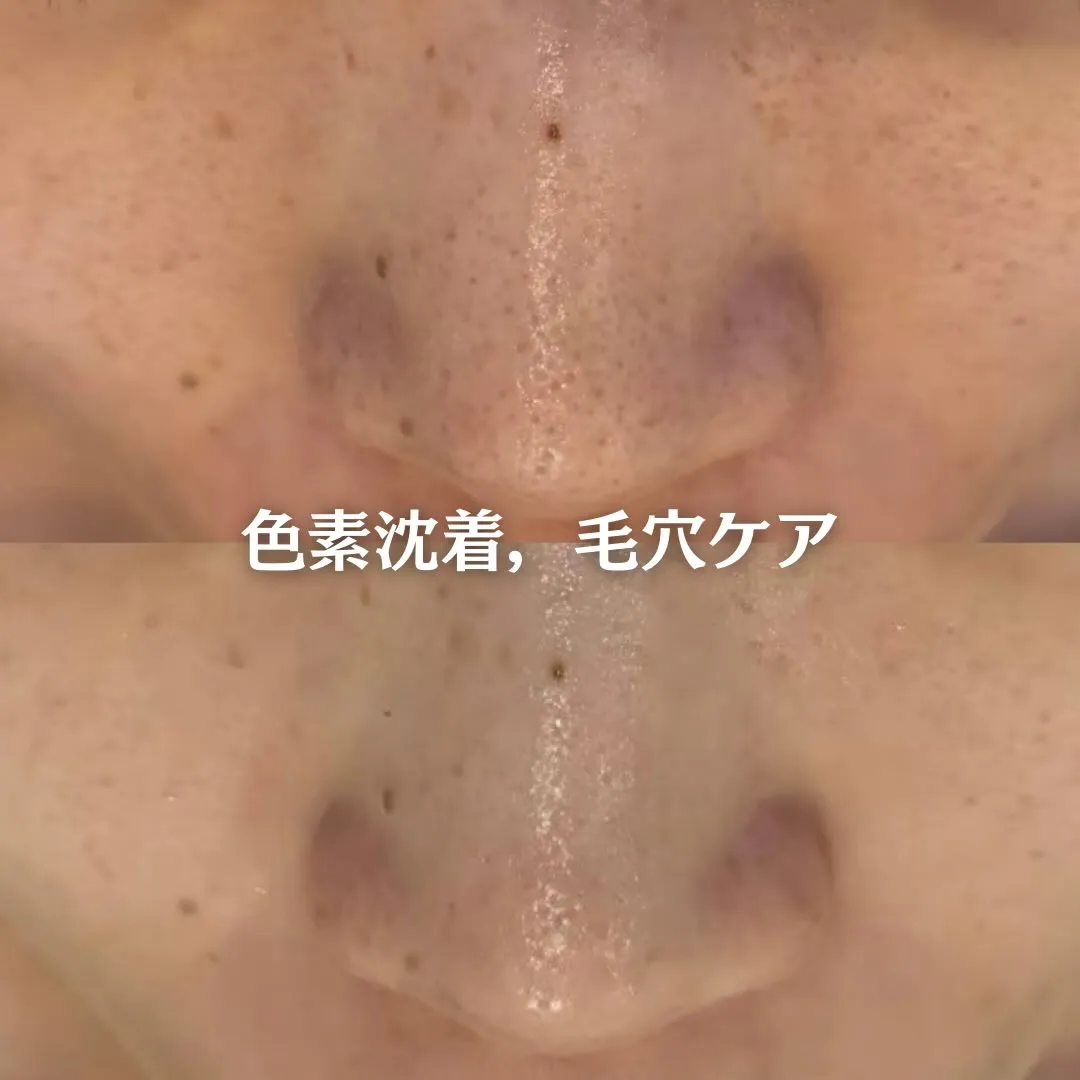 @beautysalonfacile 👈🏻他投稿もチェック