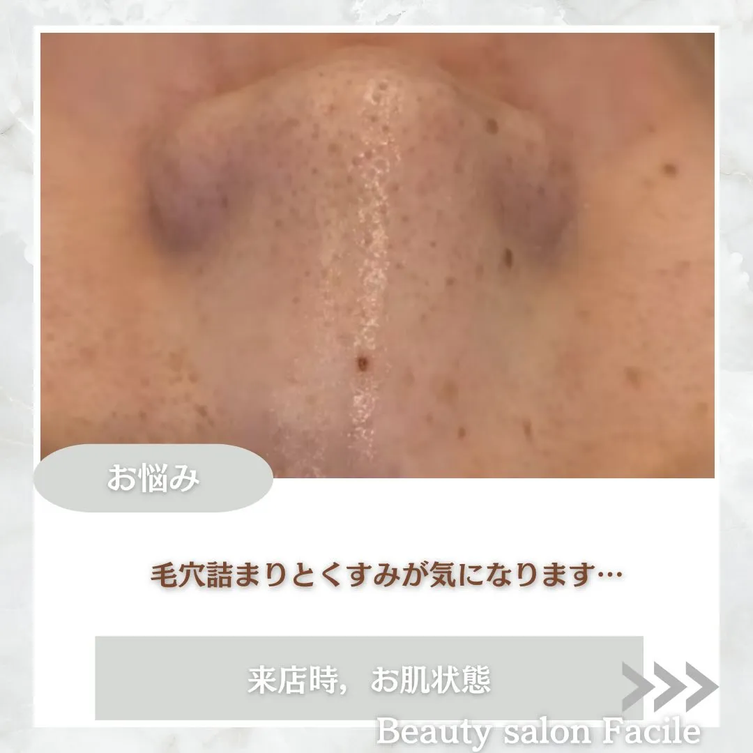 @beautysalonfacile 👈🏻他投稿もチェック