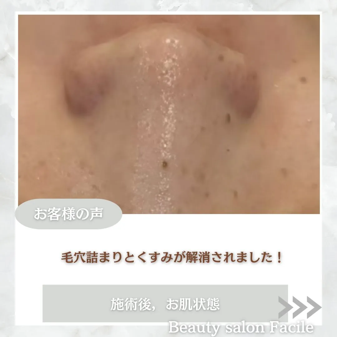 @beautysalonfacile 👈🏻他投稿もチェック