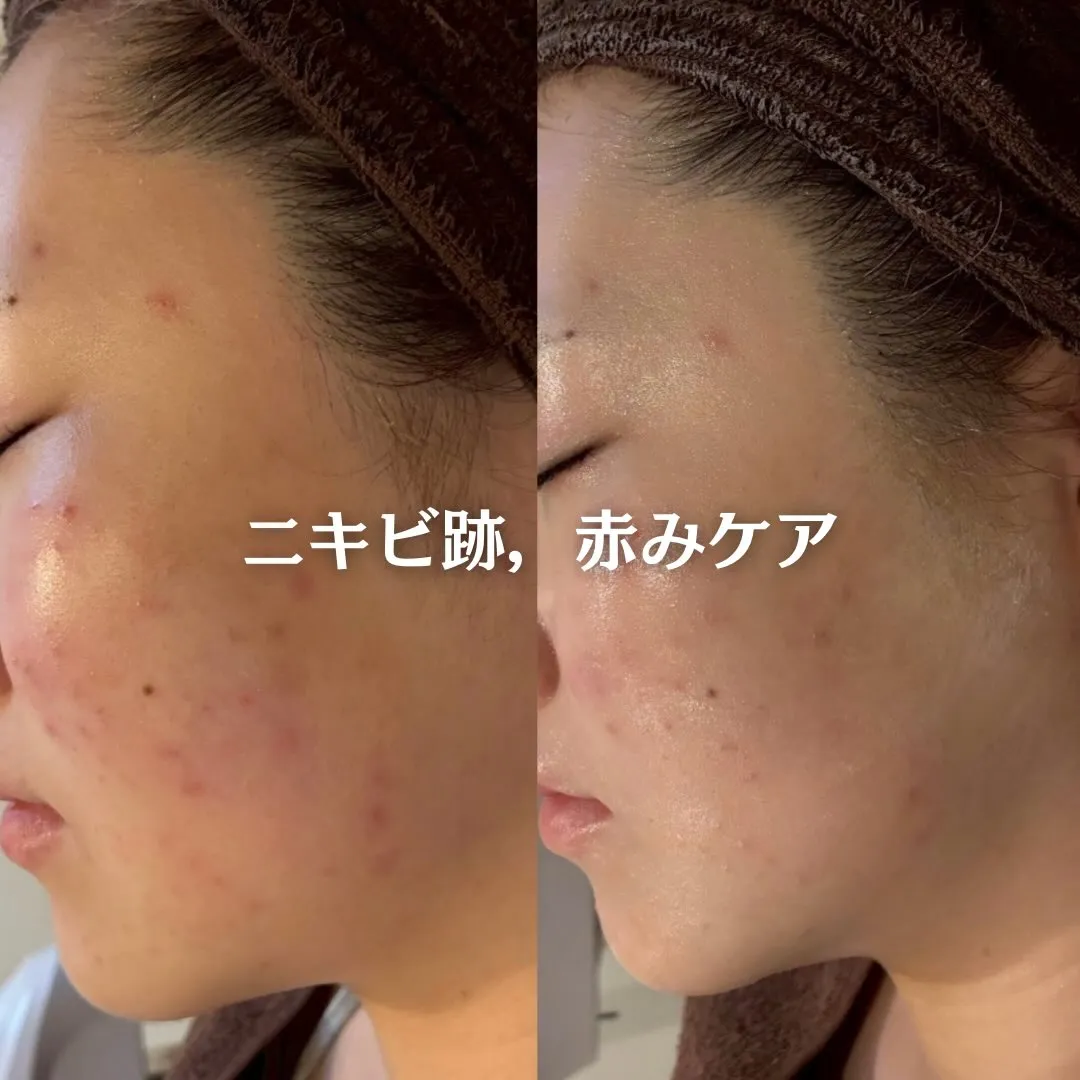 @beautysalonfacile 👈🏻他投稿もチェック