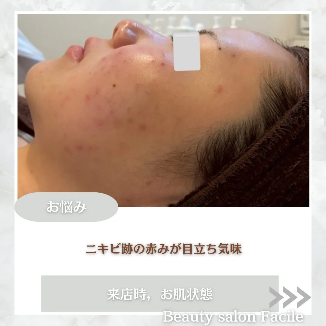 @beautysalonfacile 👈🏻他投稿もチェック