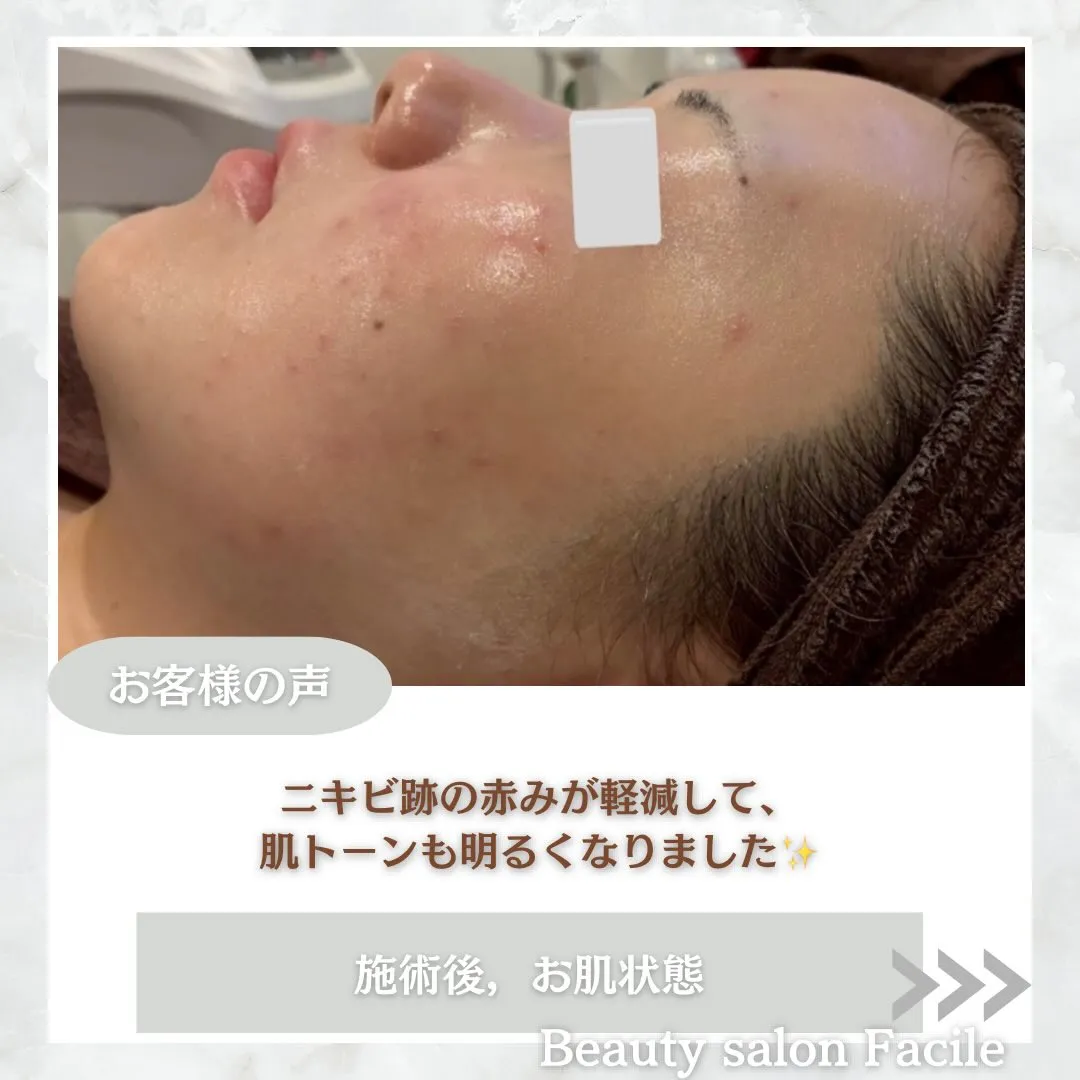 @beautysalonfacile 👈🏻他投稿もチェック