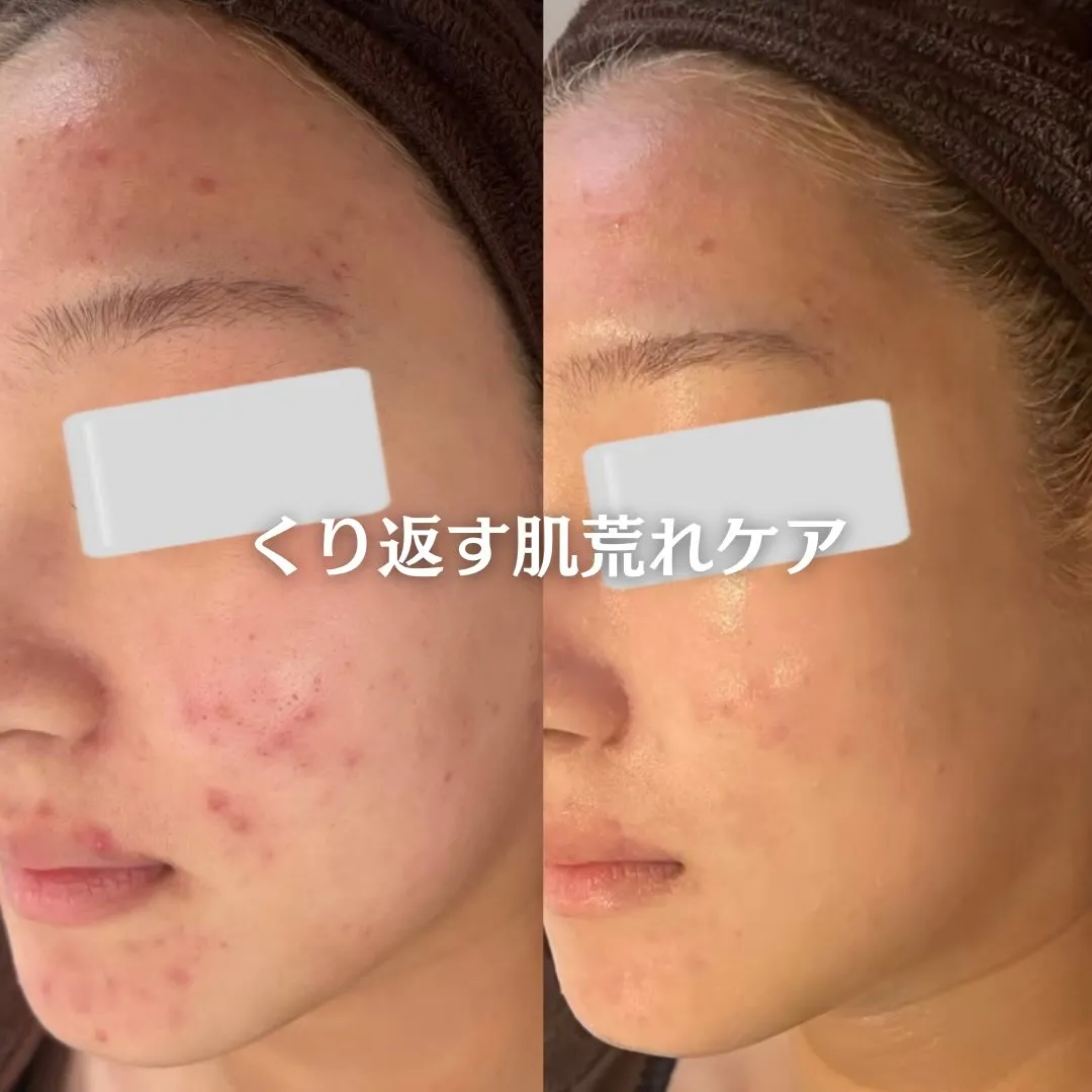 @beautysalonfacile 👈🏻他投稿もチェック