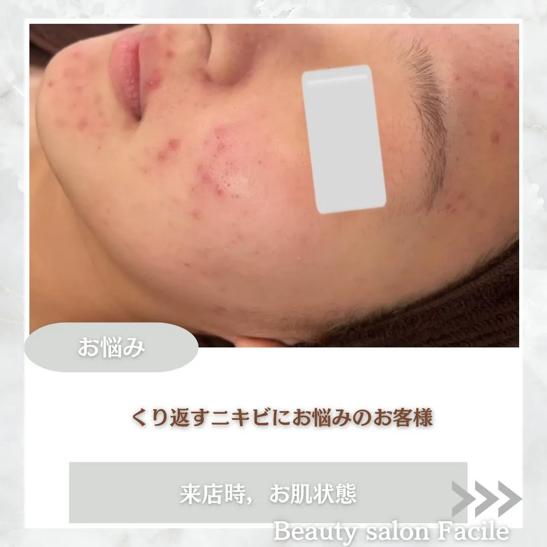 @beautysalonfacile 👈🏻他投稿もチェック