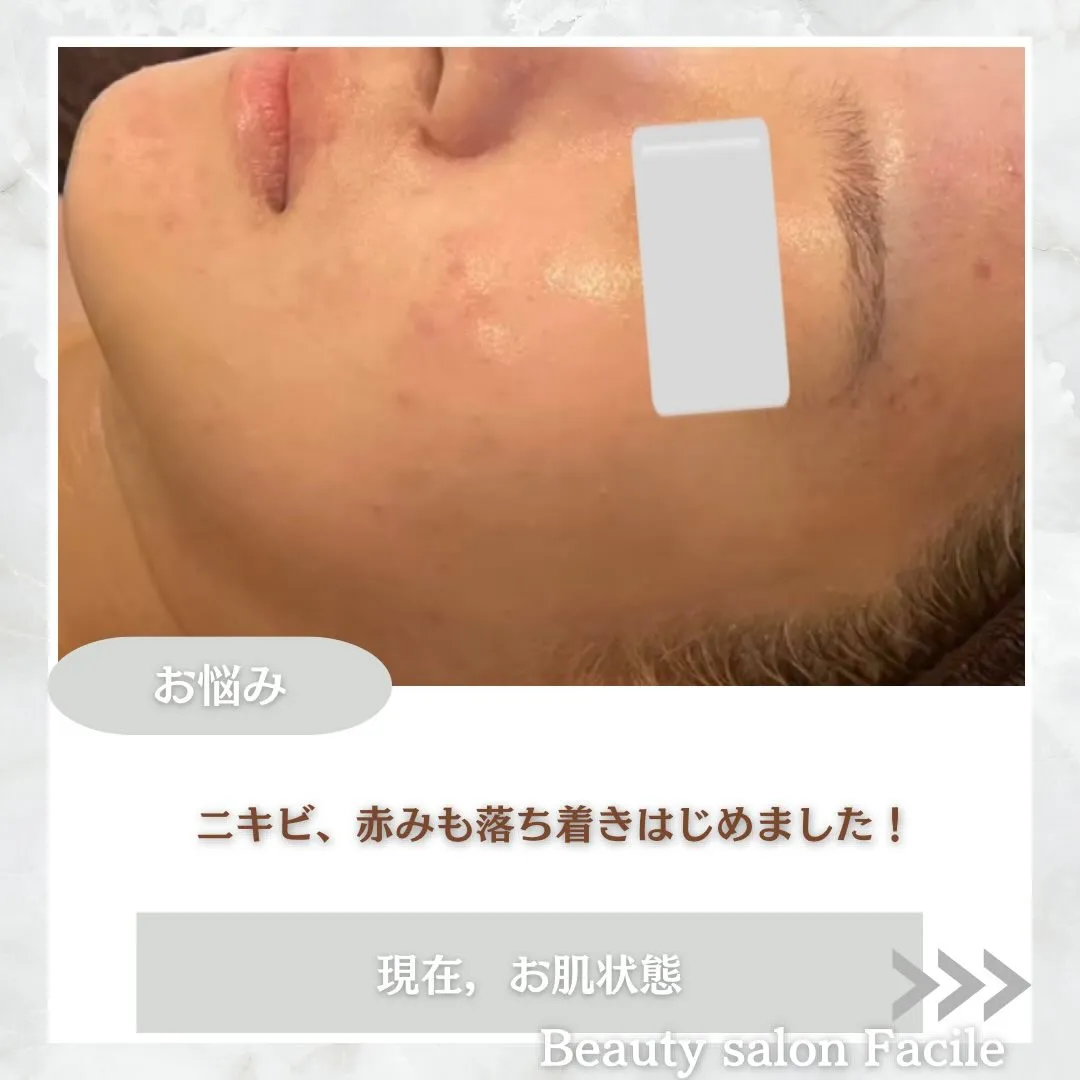@beautysalonfacile 👈🏻他投稿もチェック