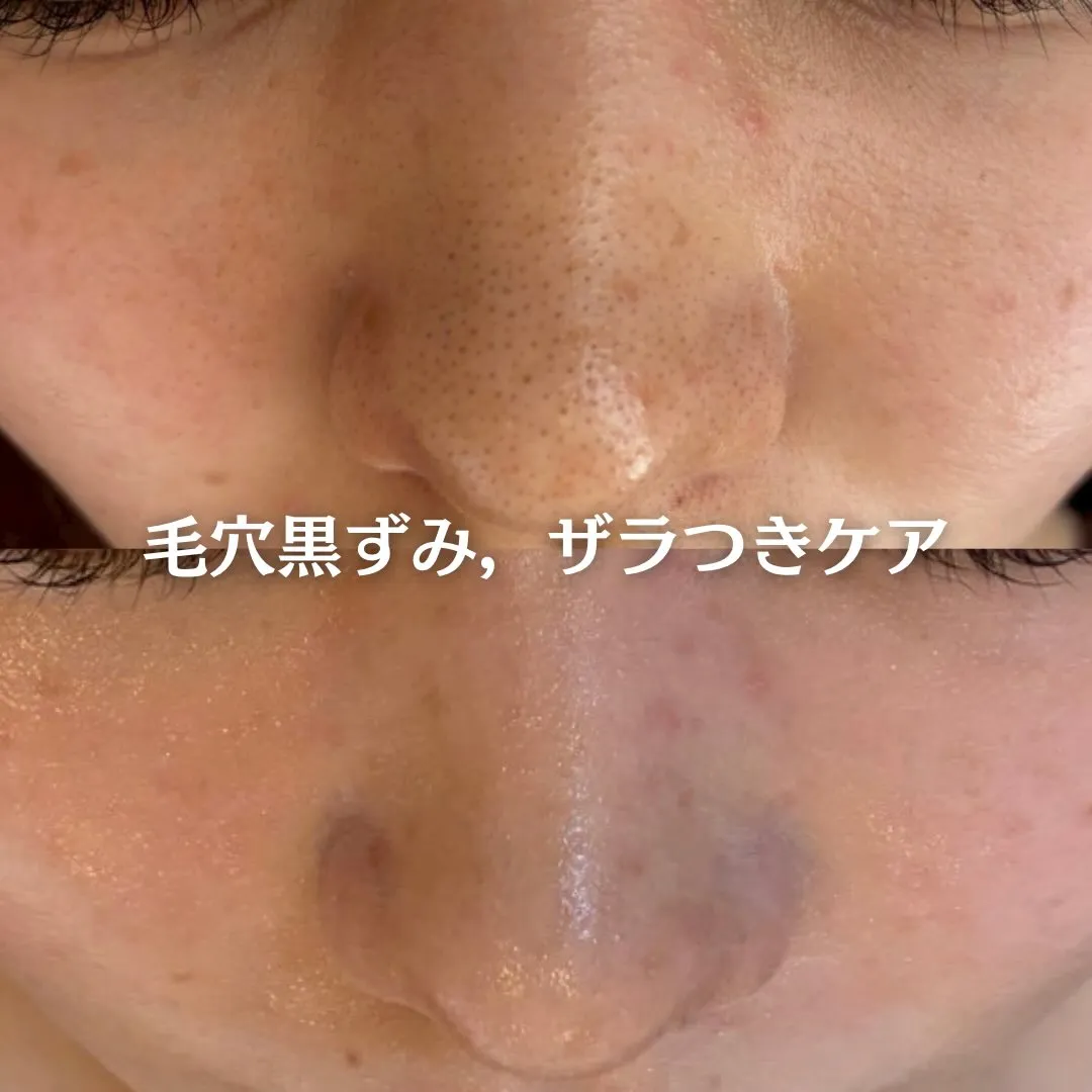@beautysalonfacile 👈🏻他投稿もチェック