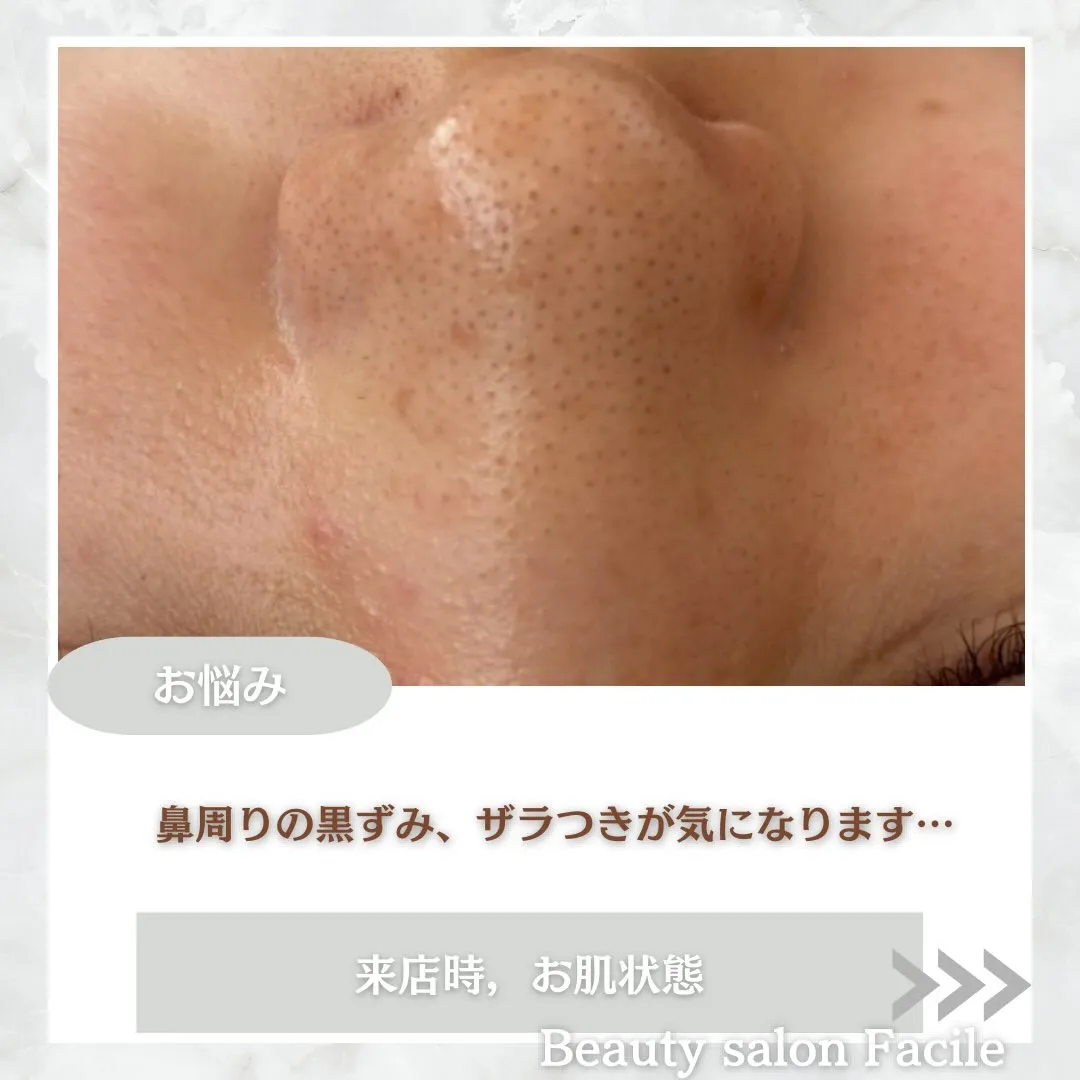 @beautysalonfacile 👈🏻他投稿もチェック