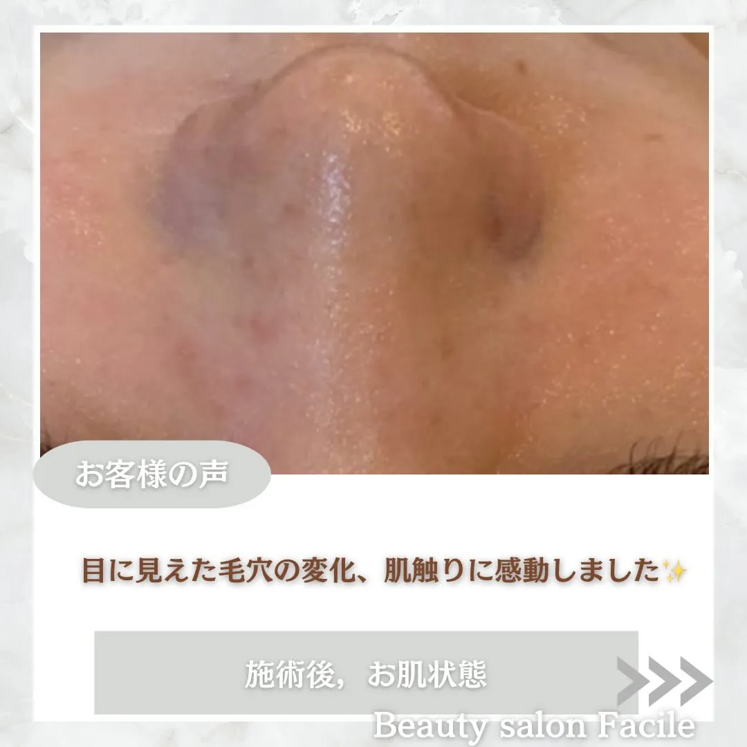 @beautysalonfacile 👈🏻他投稿もチェック