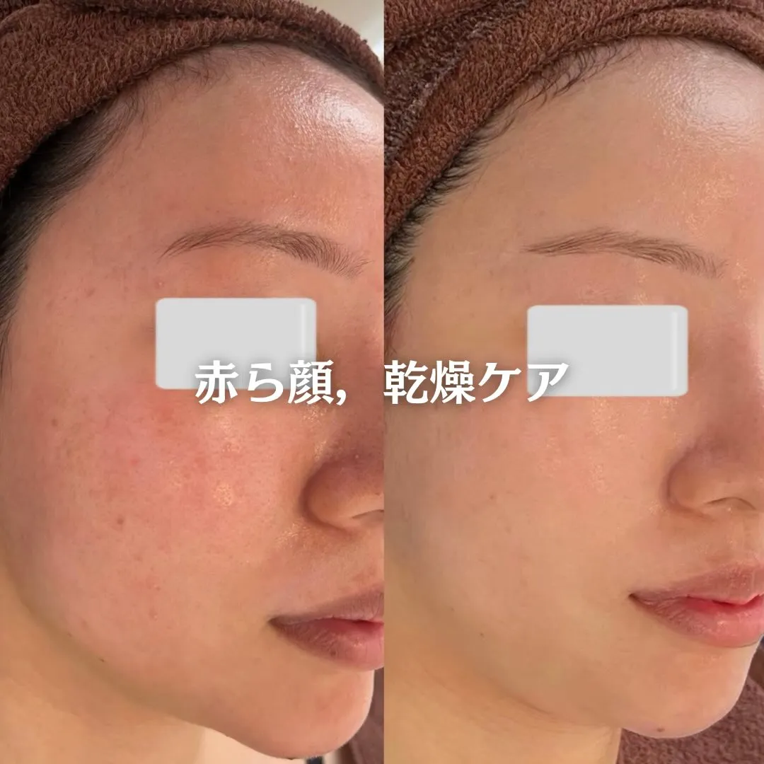@beautysalonfacile 👈🏻他投稿もチェック
