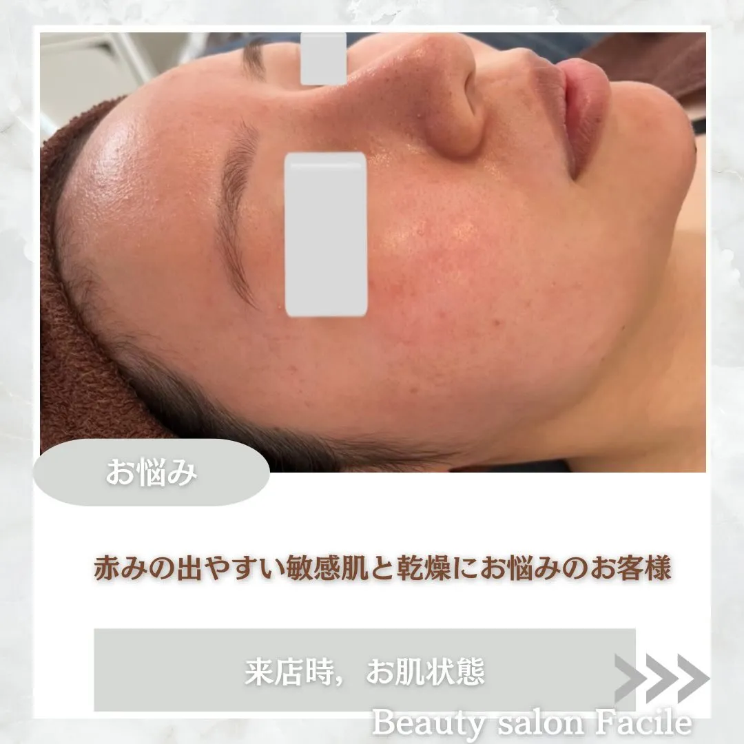 @beautysalonfacile 👈🏻他投稿もチェック