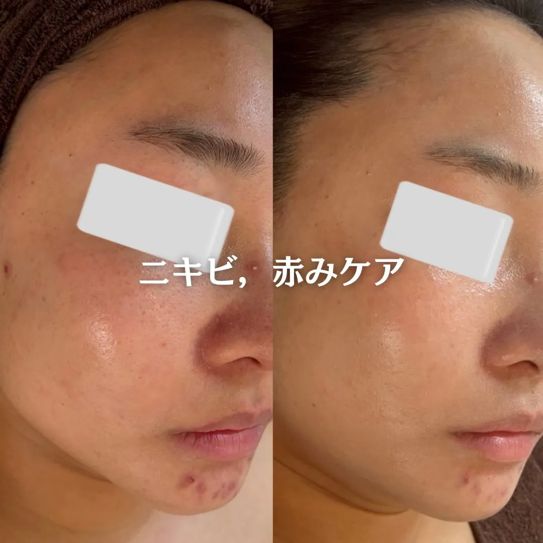 @beautysalonfacile 👈🏻他投稿もチェック