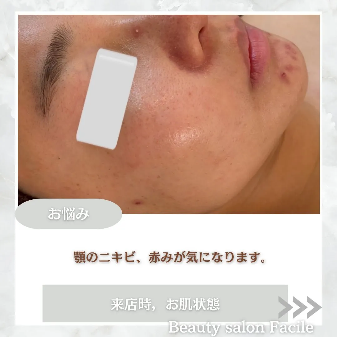 @beautysalonfacile 👈🏻他投稿もチェック