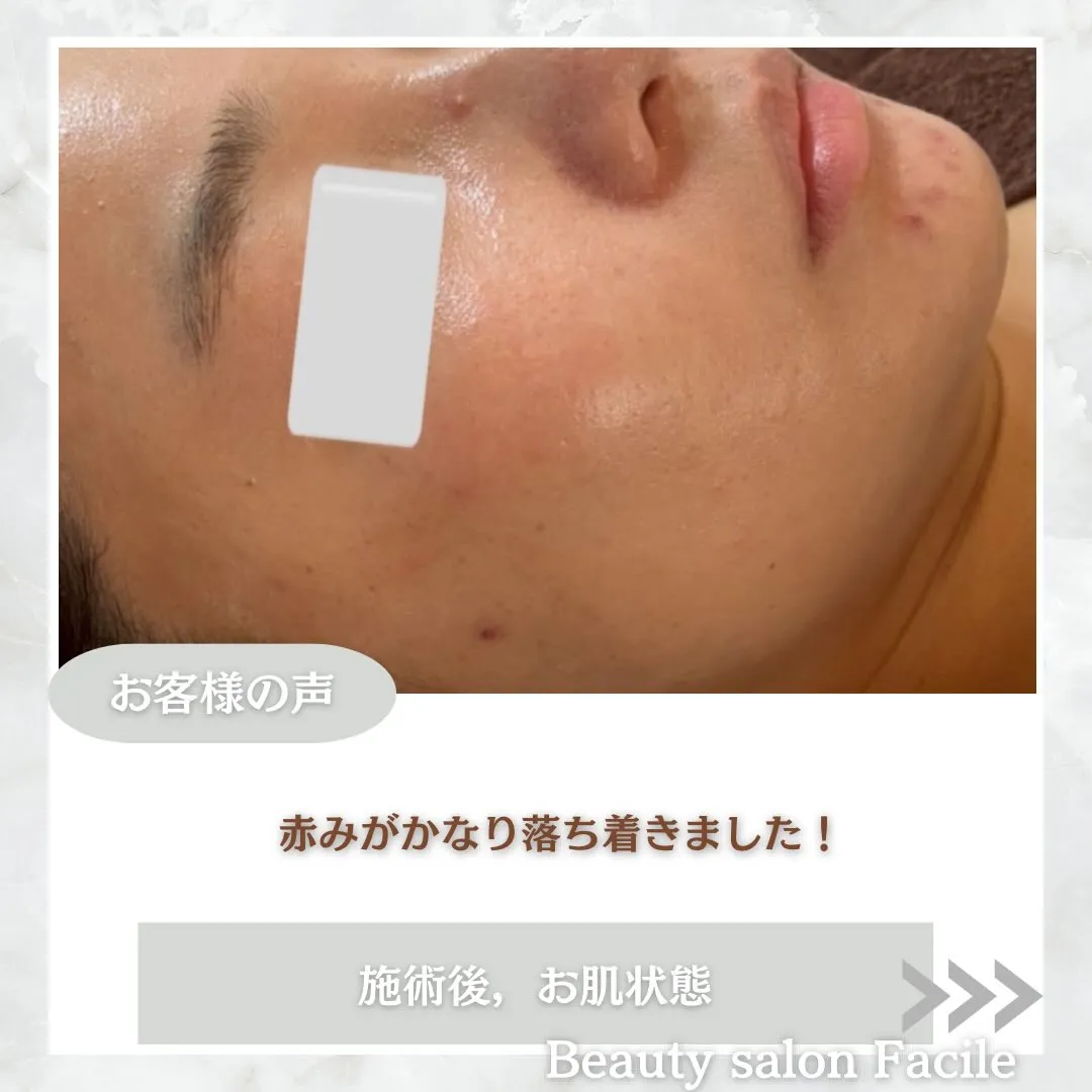 @beautysalonfacile 👈🏻他投稿もチェック