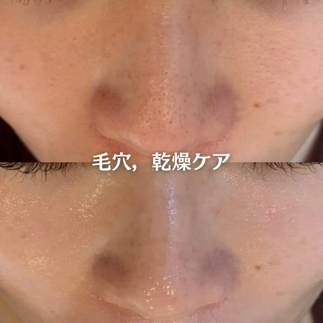 @beautysalonfacile 👈🏻他投稿もチェック