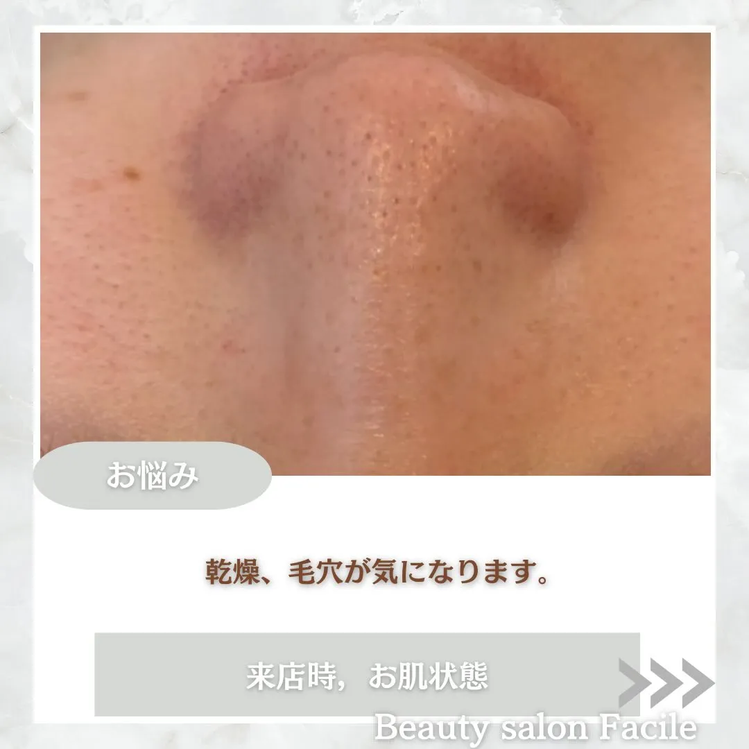 @beautysalonfacile 👈🏻他投稿もチェック