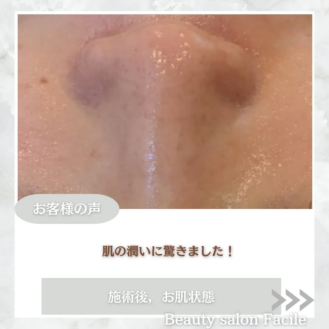 @beautysalonfacile 👈🏻他投稿もチェック