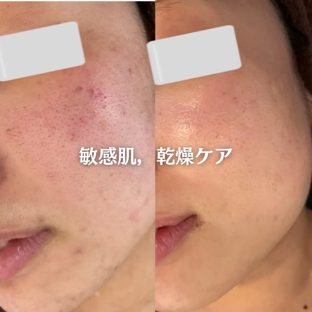 @beautysalonfacile 👈🏻他投稿もチェック