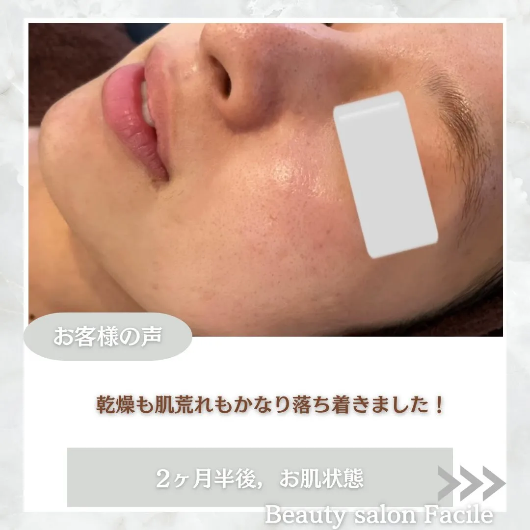 @beautysalonfacile 👈🏻他投稿もチェック