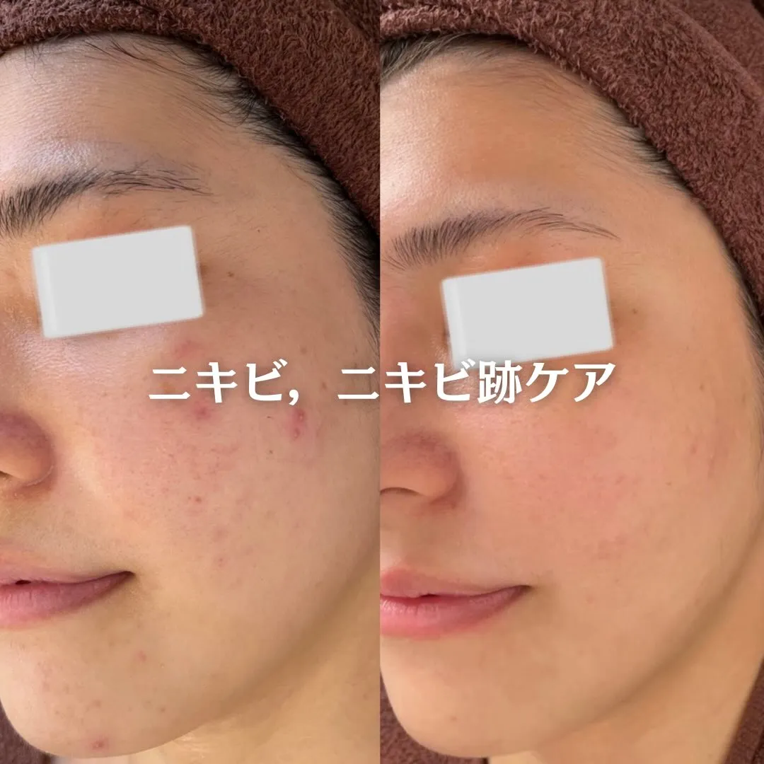 @beautysalonfacile 👈🏻他投稿もチェック