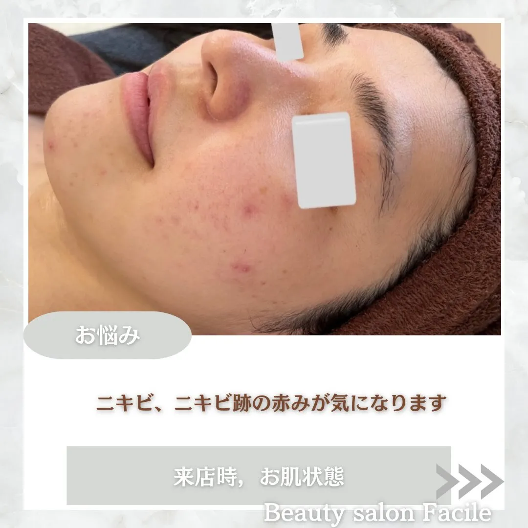 @beautysalonfacile 👈🏻他投稿もチェック