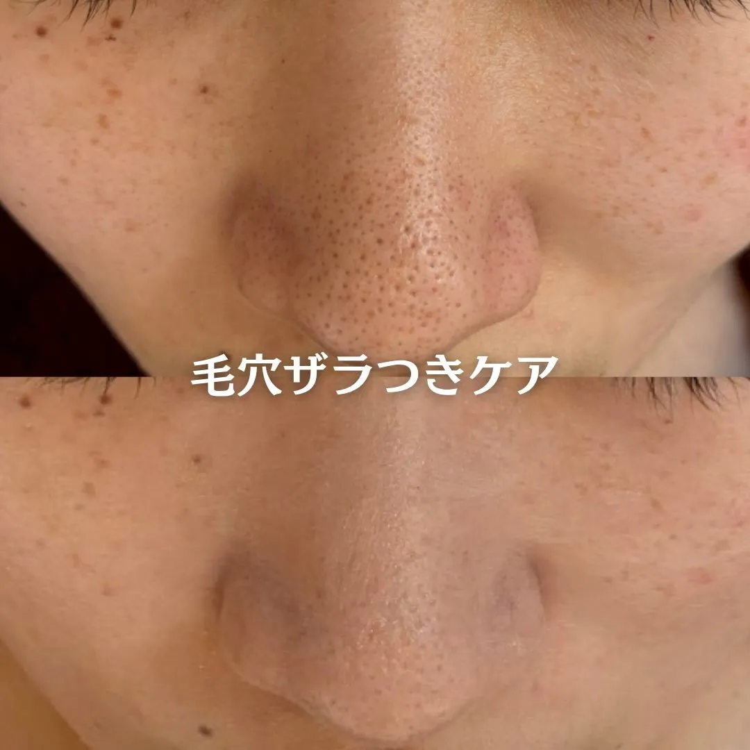 @beautysalonfacile 👈🏻他投稿もチェック