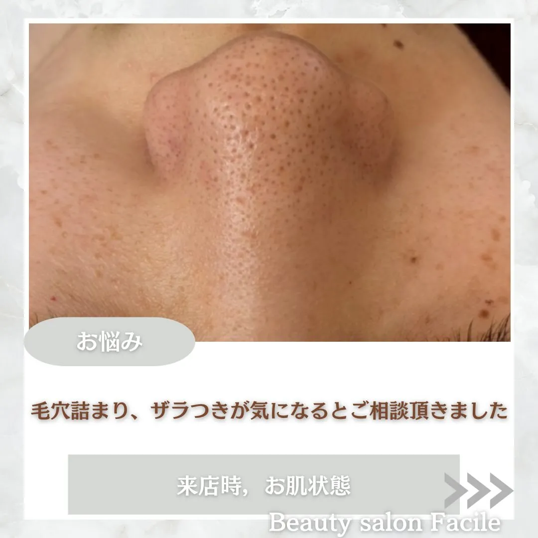 @beautysalonfacile 👈🏻他投稿もチェック