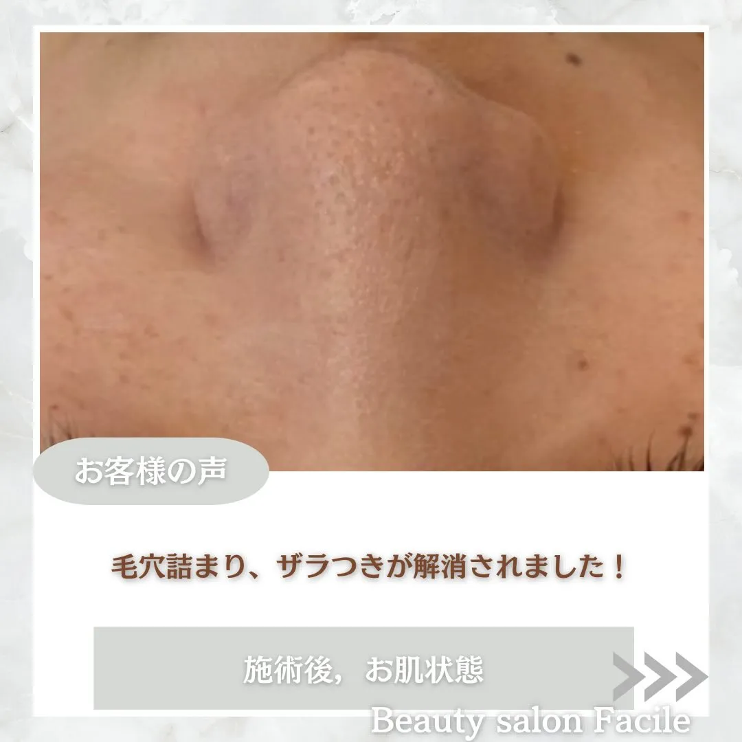@beautysalonfacile 👈🏻他投稿もチェック