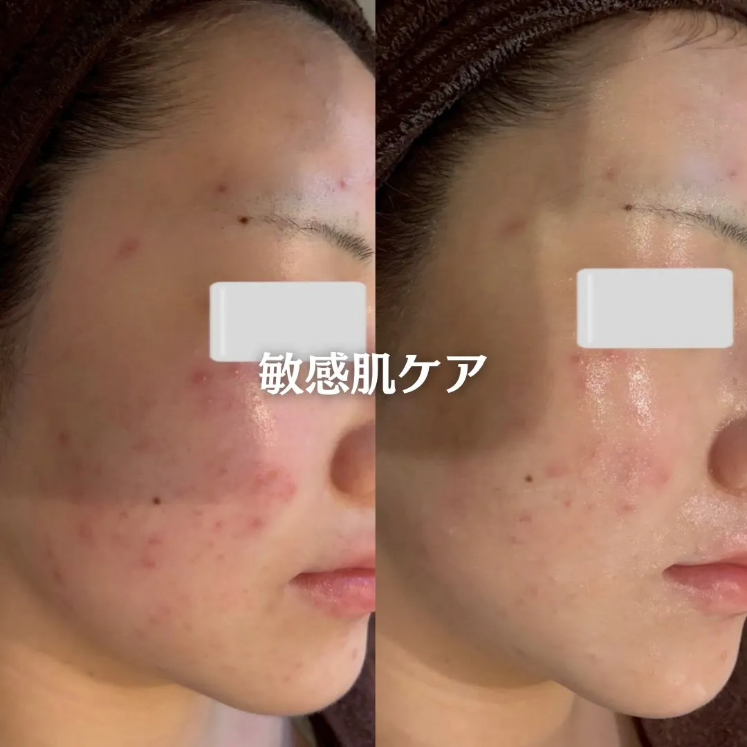 @beautysalonfacile 👈🏻他投稿もチェック