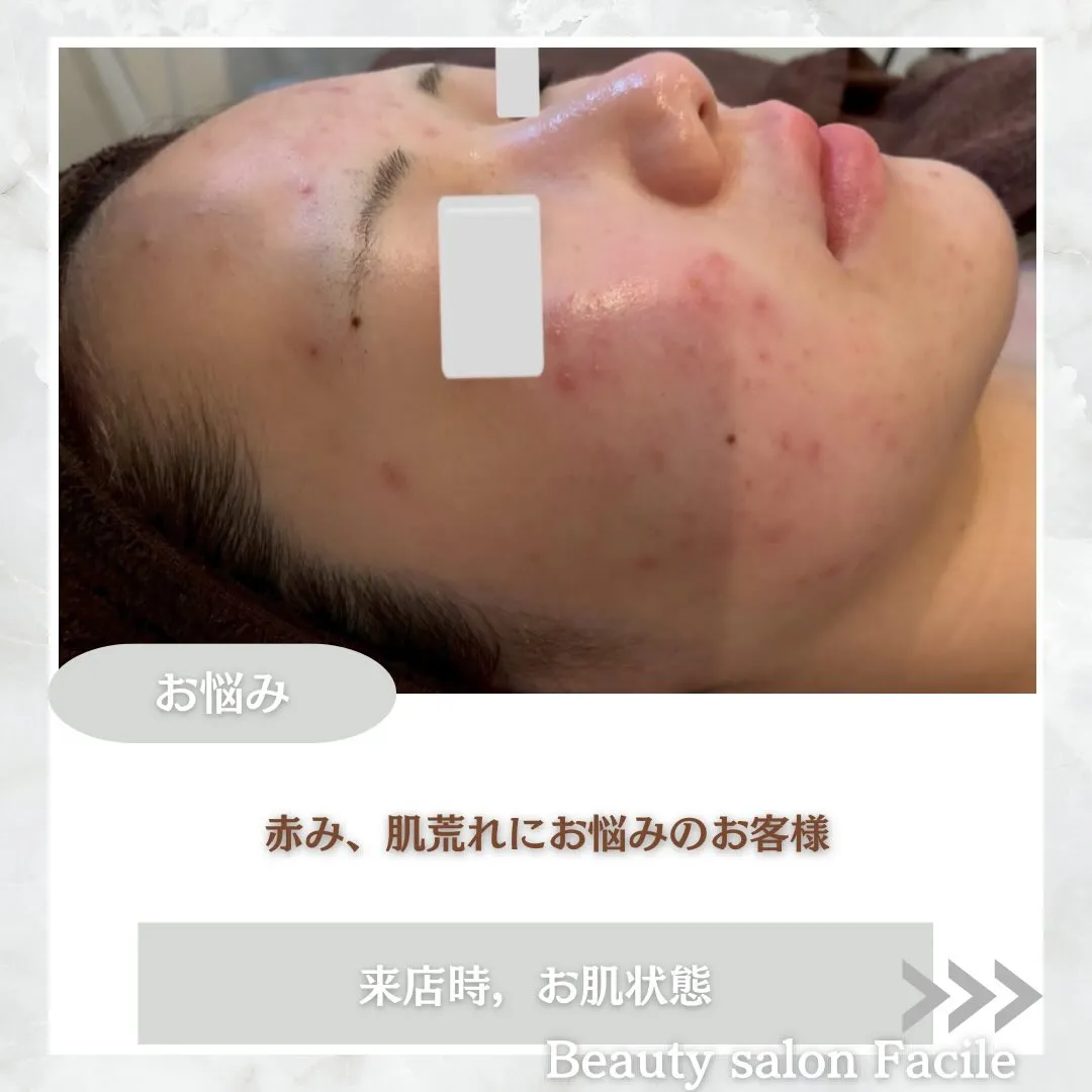 @beautysalonfacile 👈🏻他投稿もチェック