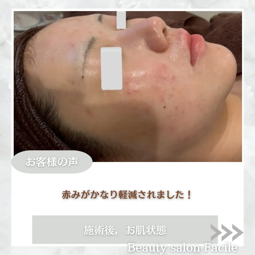 @beautysalonfacile 👈🏻他投稿もチェック