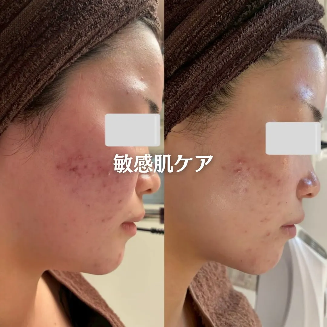 @beautysalonfacile 👈🏻他投稿もチェック