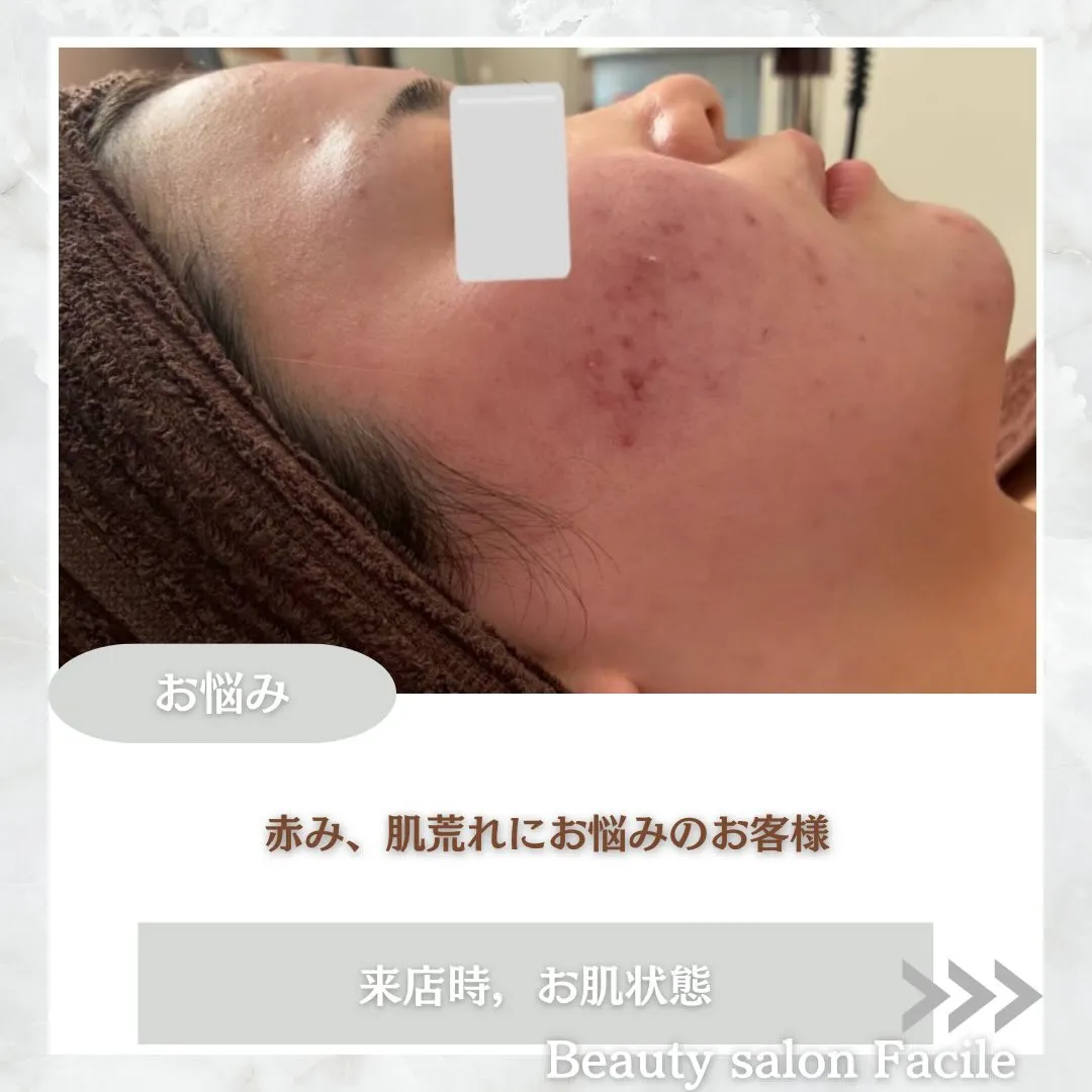 @beautysalonfacile 👈🏻他投稿もチェック