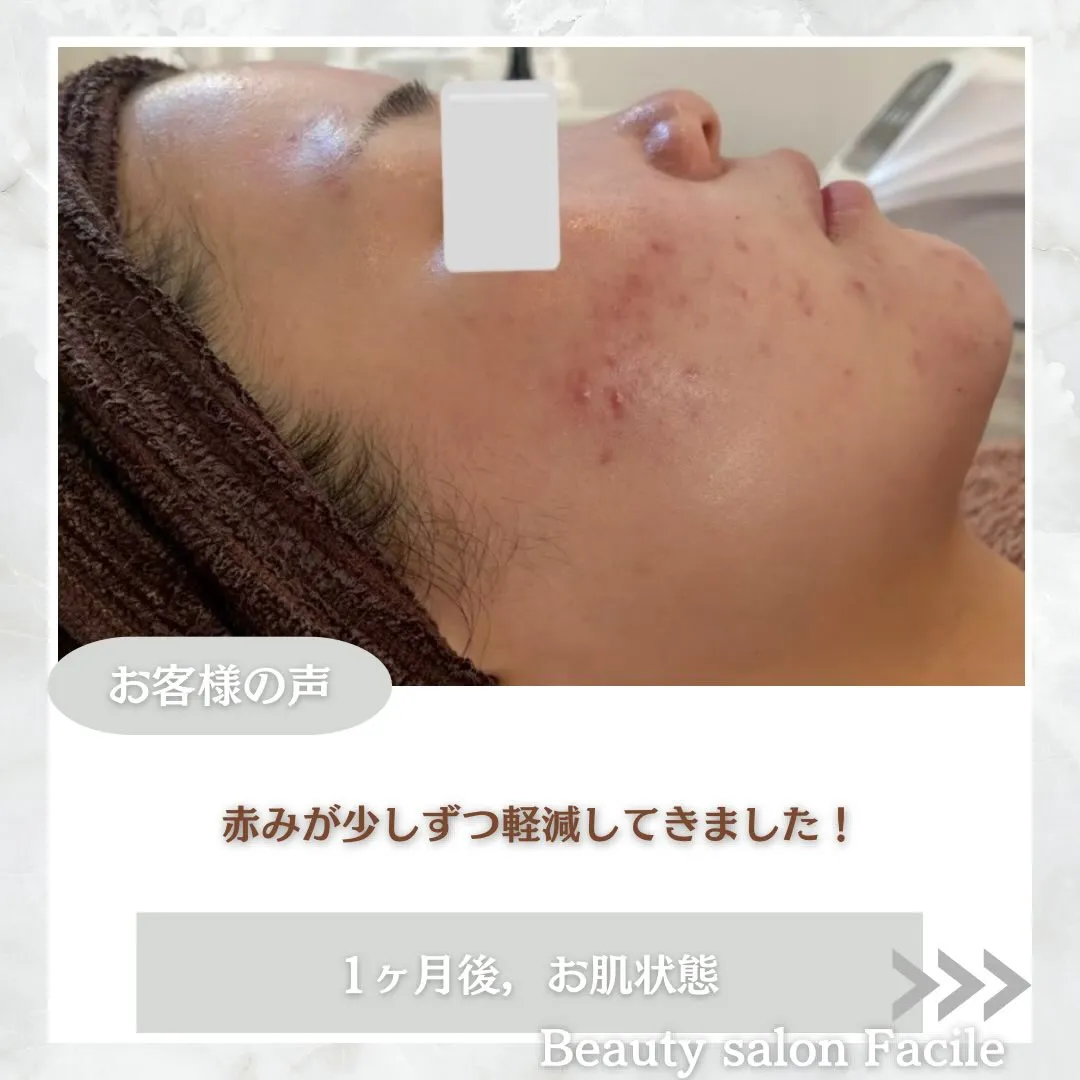 @beautysalonfacile 👈🏻他投稿もチェック