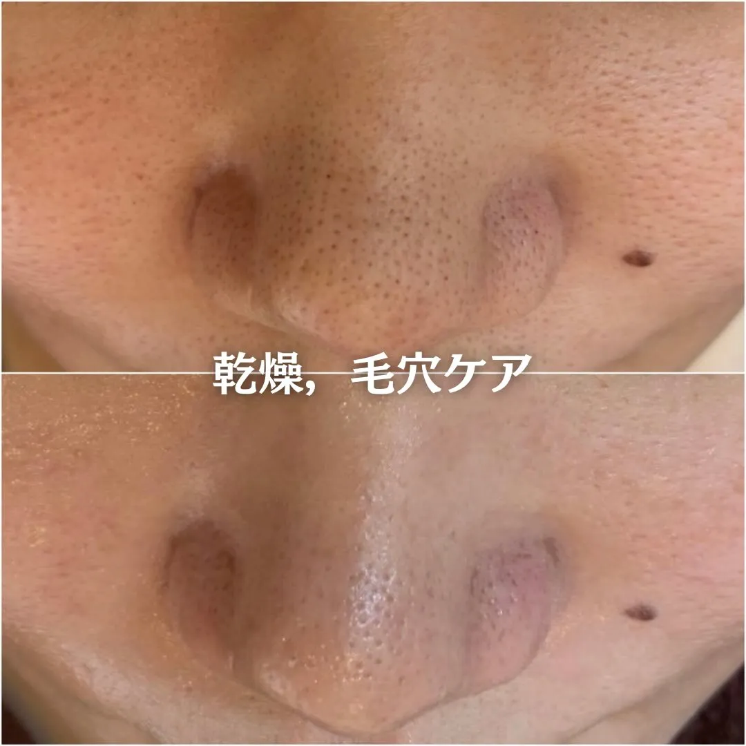 @beautysalonfacile 👈🏻他投稿もチェック