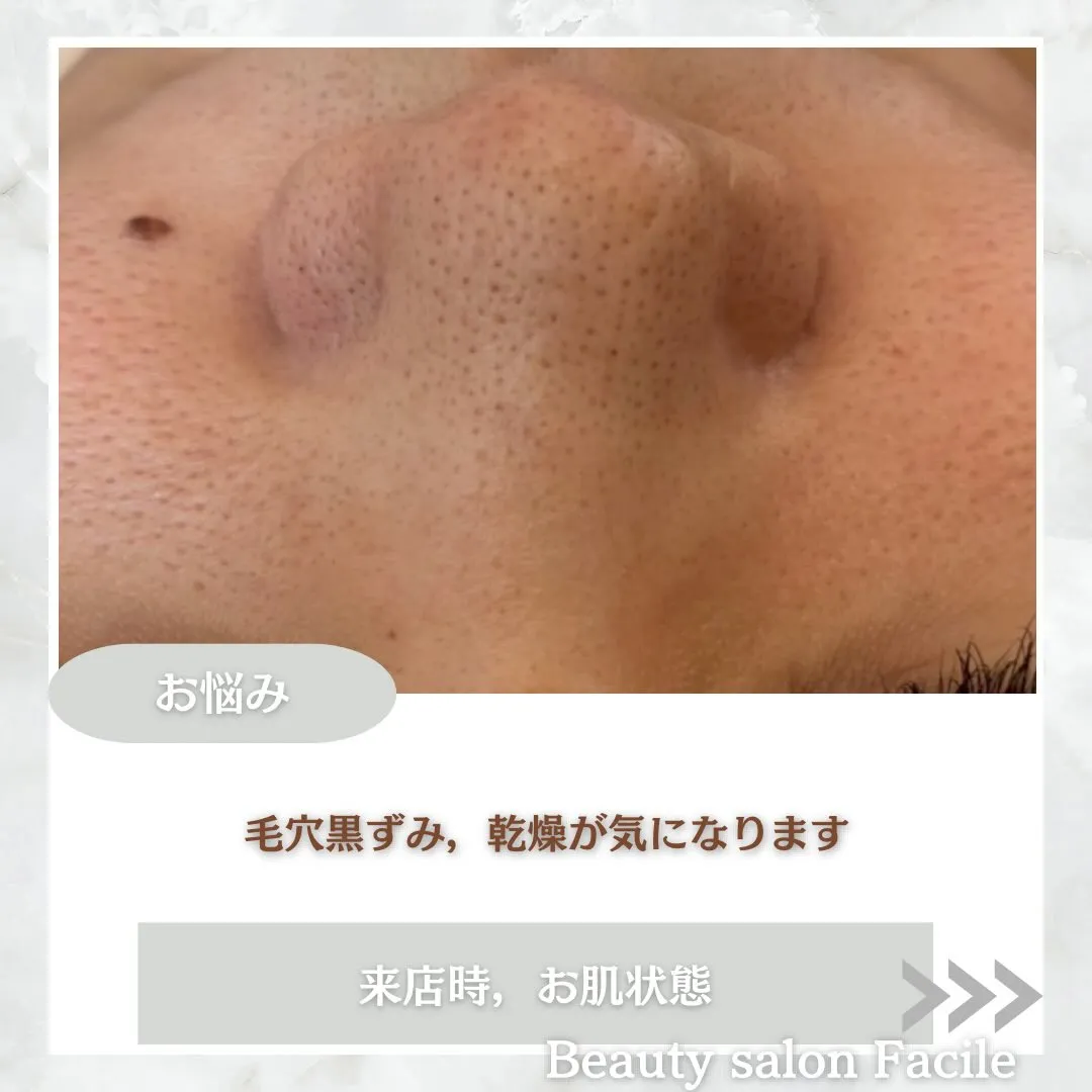 @beautysalonfacile 👈🏻他投稿もチェック