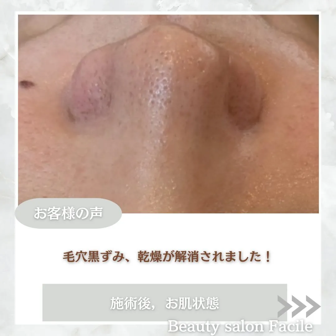 @beautysalonfacile 👈🏻他投稿もチェック