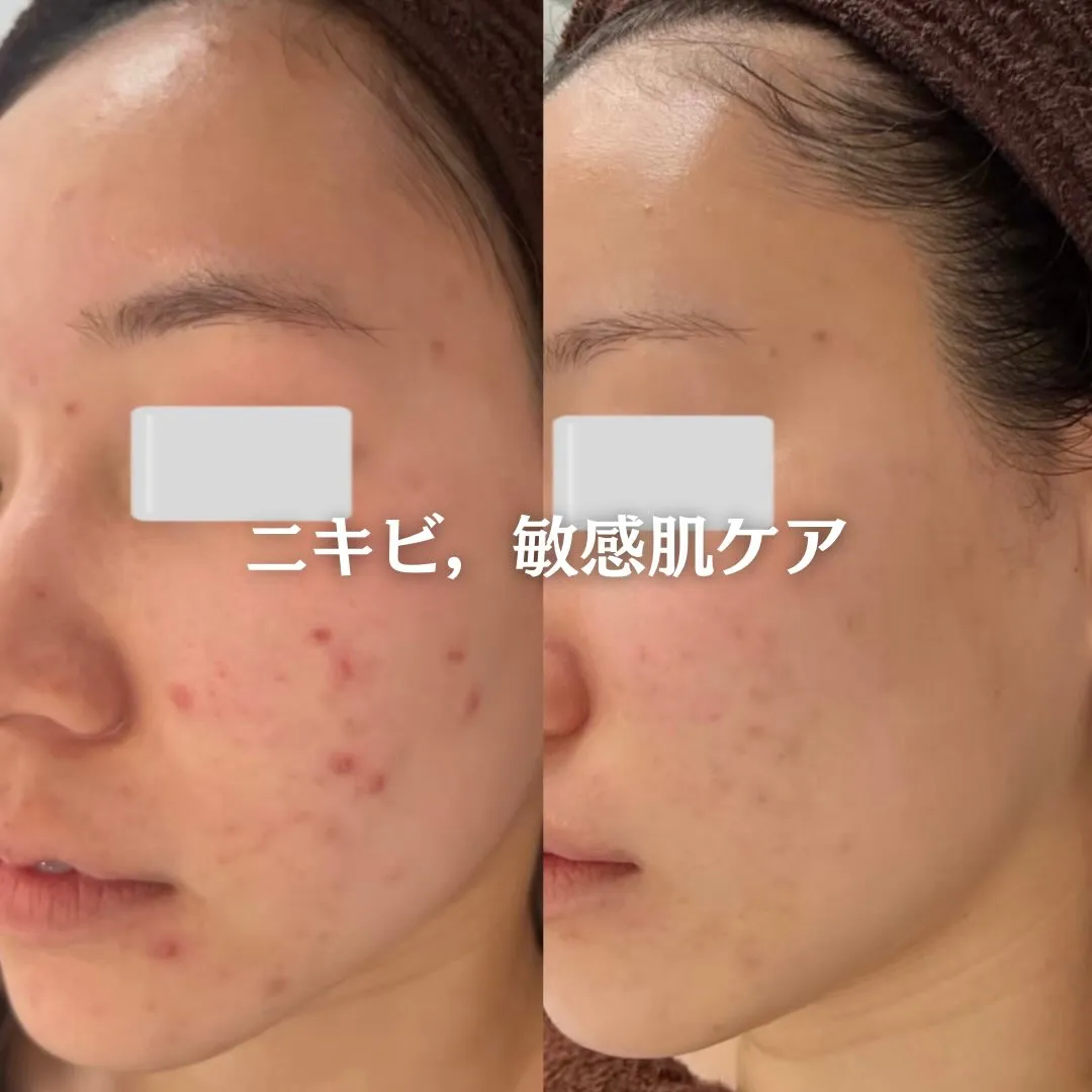 @beautysalonfacile 👈🏻他投稿もチェック