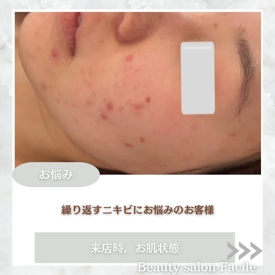 @beautysalonfacile 👈🏻他投稿もチェック