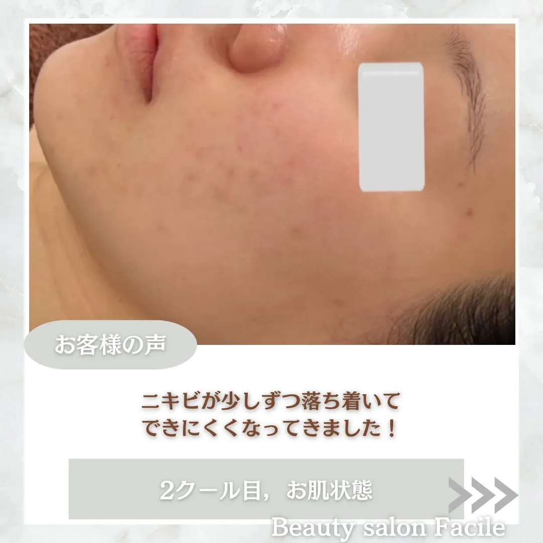 @beautysalonfacile 👈🏻他投稿もチェック