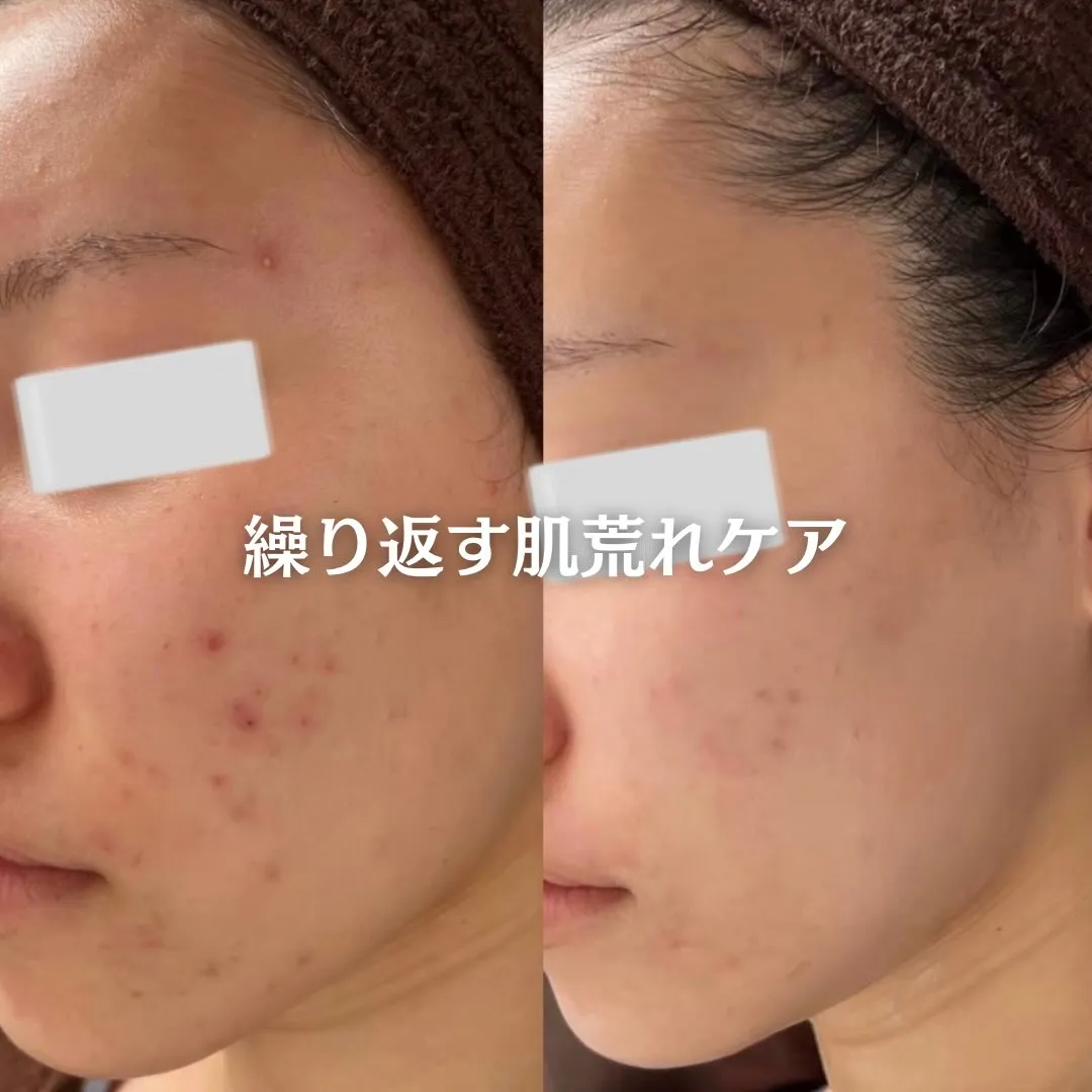 @beautysalonfacile 👈🏻他投稿もチェック