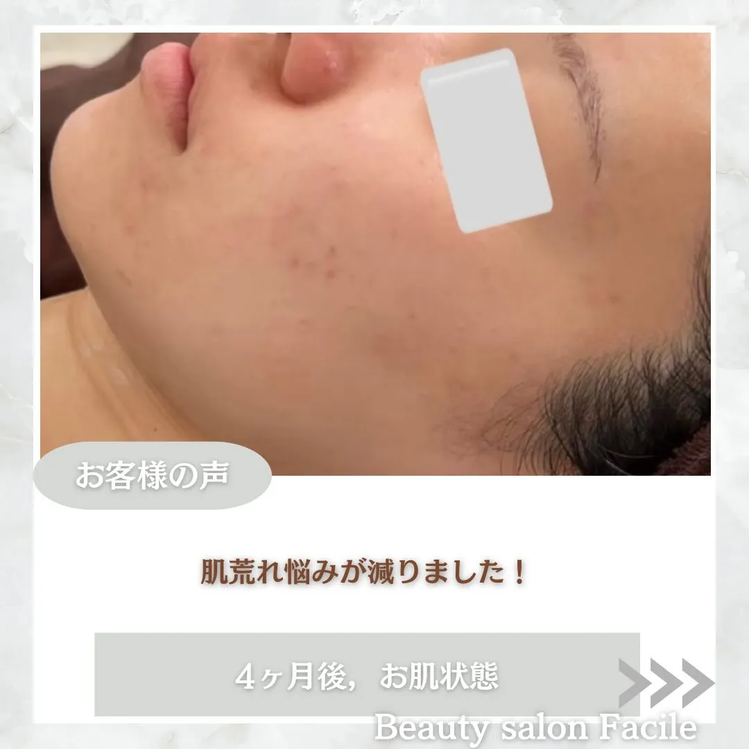 @beautysalonfacile 👈🏻他投稿もチェック