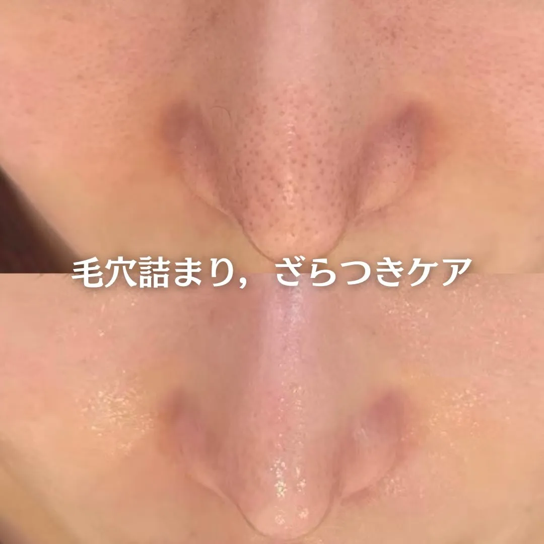 @beautysalonfacile 👈🏻他投稿もチェック